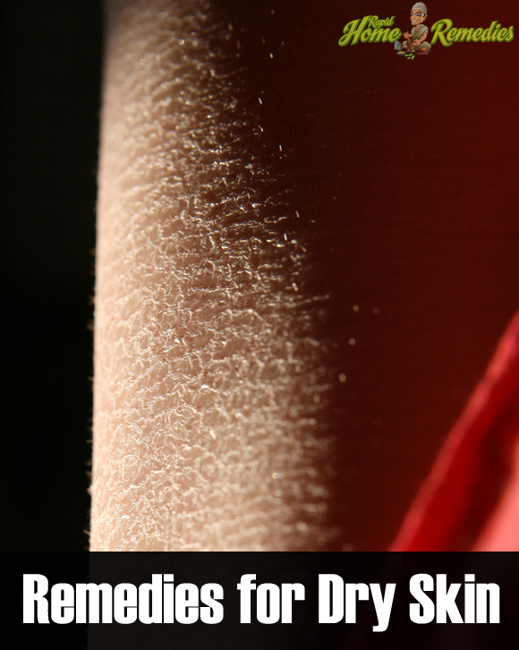 7 Best Natural Remedies for Dry Skin