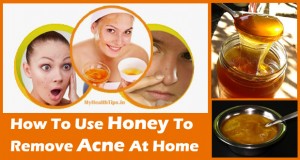 Honey for Acne - Use Honey to Remove Acne & Scars Fast