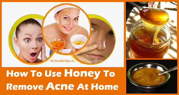 Honey For Acne Use Honey To Remove Acne And Scars Fast
