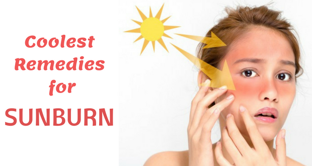 17 Coolest Remedies for Sunburn